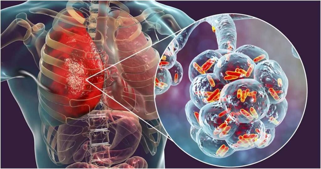 tbn24 20250814235937 8703 legionnaies