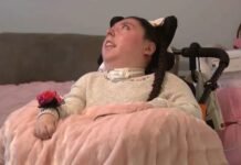 মস্তিষ্ক ছাড়াও ২০ বছর ধরে বেঁচে থাকা মেয়ের গল্প